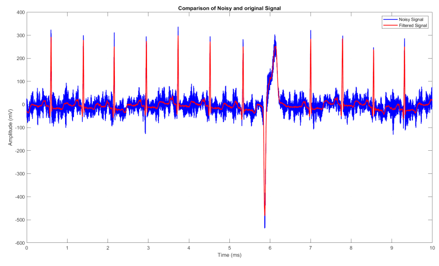 Filtered ECG waveform visualisation for DSP coursework